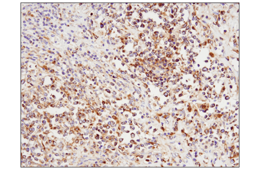 Immunohistochemistry Image 5: Rab7 (E9O7E) Mouse Monoclonal Antibody