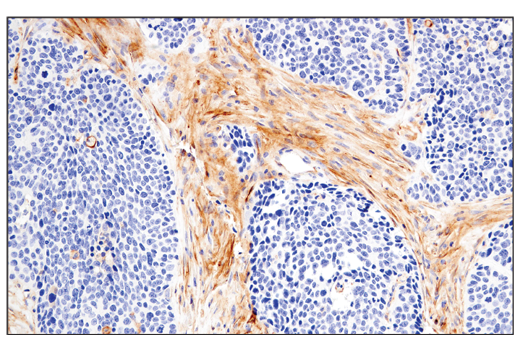 Immunohistochemistry Image 1: CD54/ICAM-1 (E3Q9N) XP<sup>®</sup> Rabbit mAb