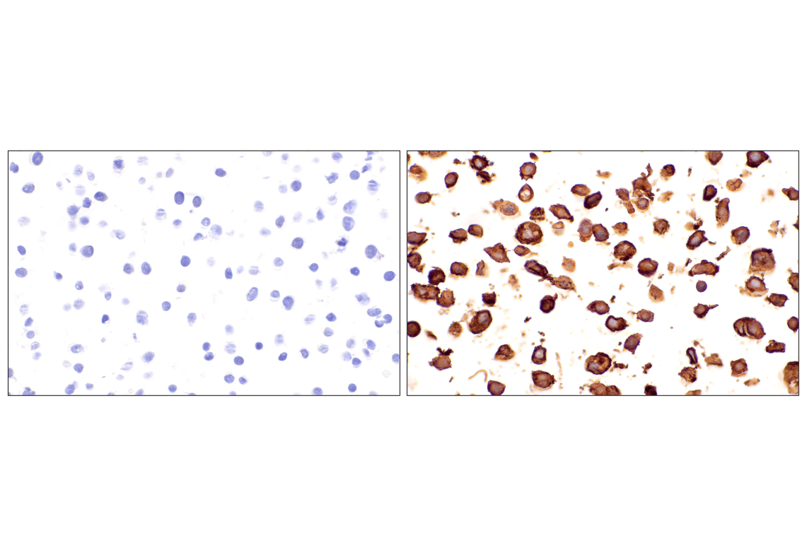 Immunohistochemistry Image 16: EMCN (E3Z4D) Rabbit Monoclonal Antibody (BSA and Azide Free)