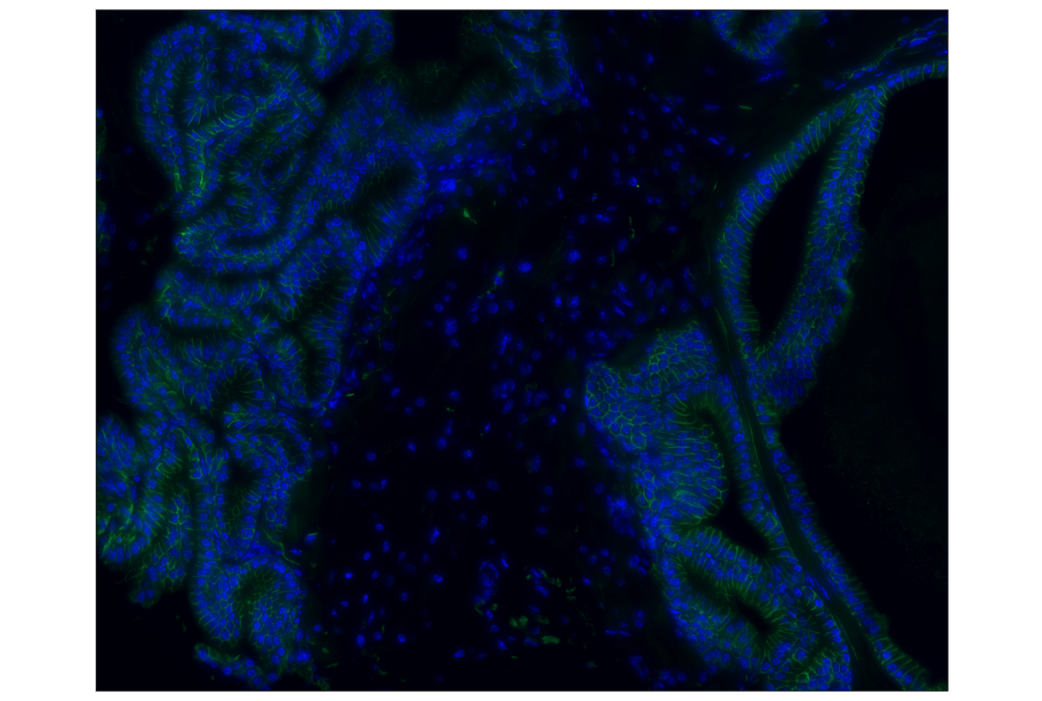 Immunohistochemistry Image 2: NCAM1 (CD56) (E7X9M) Rabbit Monoclonal Antibody (Alexa Fluor<sup>®</sup> 488 Conjugate)