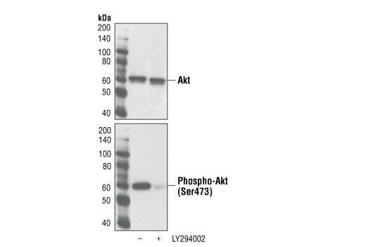 undefined Image 3: SignalSlide<sup>®</sup> Phospho-Akt (Ser473) IHC Controls