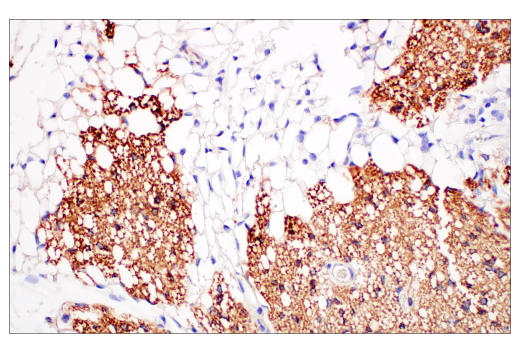 Immunohistochemistry Image 4: UCP1 (E9Z2V) Rabbit Monoclonal Antibody