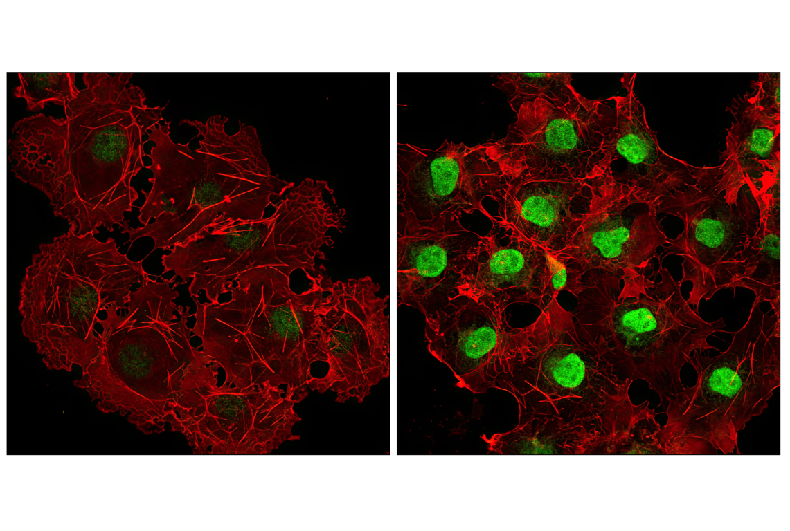 Immunofluorescence Image 1: Phospho-p38 MAPK (Thr180/Tyr182) (D3F9) Rabbit Monoclonal Antibody (BSA and Azide Free)