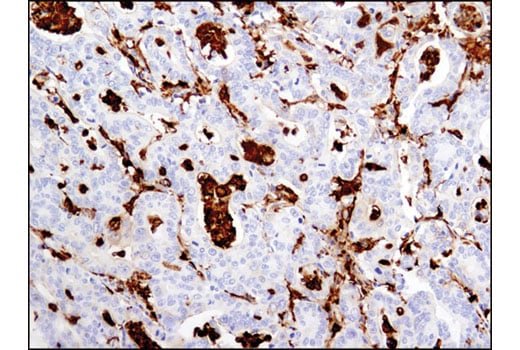 Immunohistochemistry Image 1: Gelsolin (D9W8Y) Rabbit Monoclonal Antibody (BSA and Azide Free)