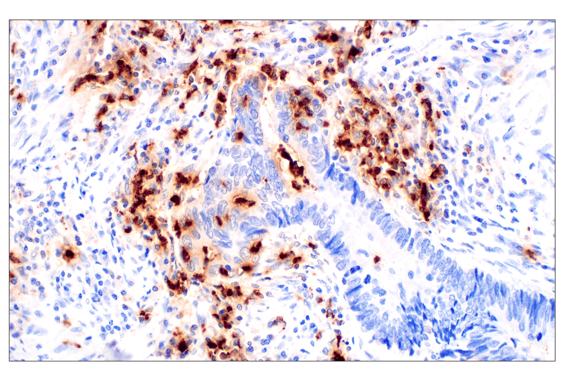 Immunohistochemistry Image 1: Neutrophil Elastase (F4H3X) Rabbit Monoclonal Antibody (BSA and Azide Free)