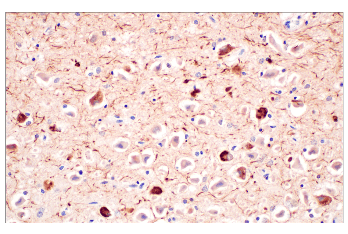 Immunohistochemistry Image 1: Phospho-Tau (Ser202) (F2A2F) Rabbit Monoclonal Antibody