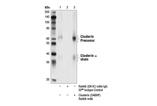 Immunoprecipitation Image 1: Clusterin (D4B6P) Rabbit Monoclonal Antibody