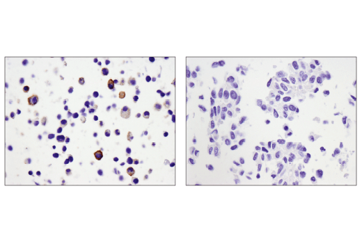Immunohistochemistry Image 3: CD39/NTPDase 1 (E2X6B) Rabbit Monoclonal Antibody (BSA and Azide Free)
