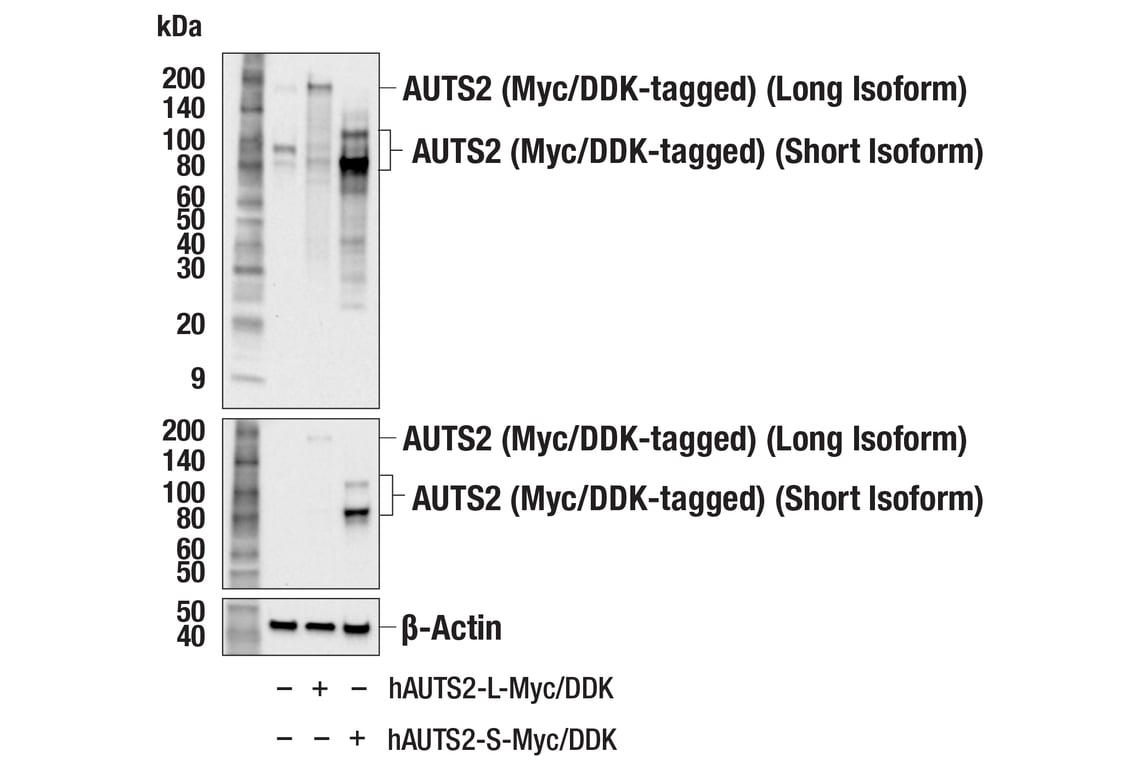 Western Blotting Image 3: AUTS2 (F3U1I) Rabbit Monoclonal Antibody