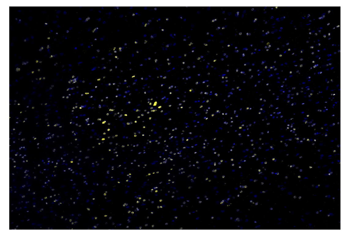 Immunohistochemistry Image 3: Olig2 (E6G6Q) & CO-0124-594 SignalStar<sup>™</sup> Oligo-Antibody Pair