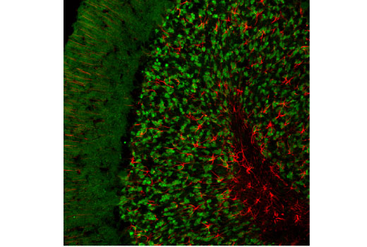 Immunofluorescence Image 1: SV2A (D1L8S) Rabbit Monoclonal Antibody (BSA and Azide Free)