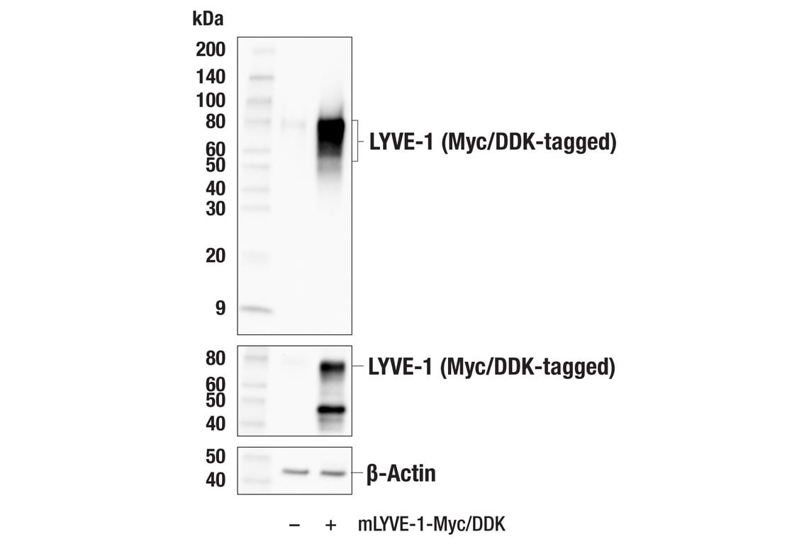 Western Blotting Image 2: LYVE-1 (E5P8S) Rabbit Monoclonal Antibody
