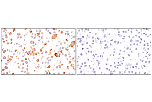 Immunohistochemistry Image 11: CTHRC1 (E8M9S) Rabbit Monoclonal Antibody