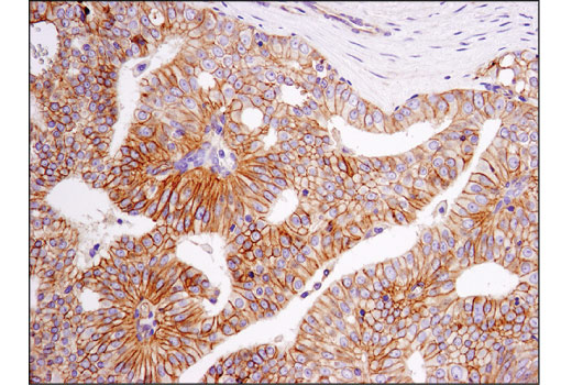 Immunohistochemistry Image 3: PVR/CD155 (D8A5G) Rabbit Monoclonal Antibody