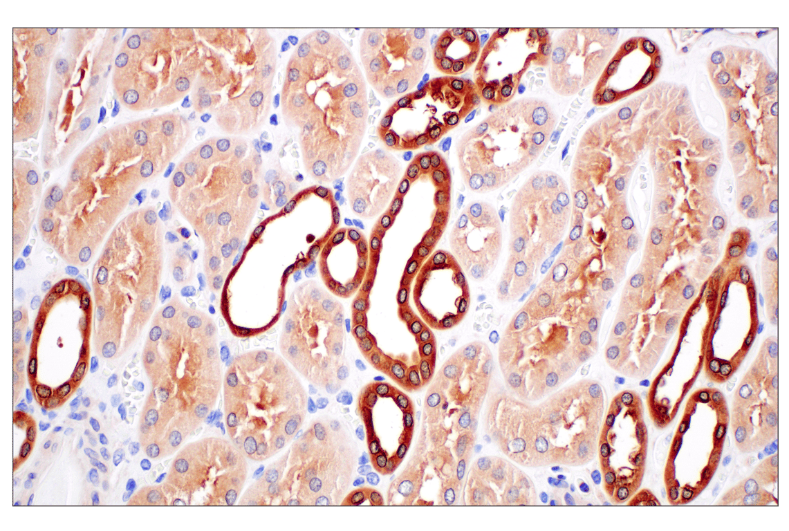 Immunohistochemistry Image 4: PIP4K2C (E7P3S) Rabbit Monoclonal Antibody
