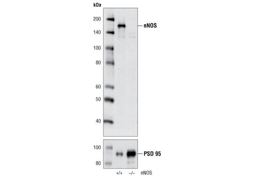 Western Blotting Image 2: nNOS (C7D7) Rabbit Monoclonal Antibody
