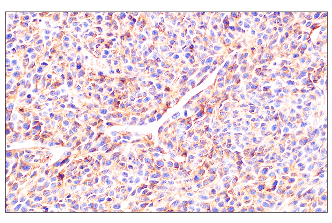 Immunohistochemistry Image 2: beta2-microglobulin (F4S6H) Rabbit Monoclonal Antibody