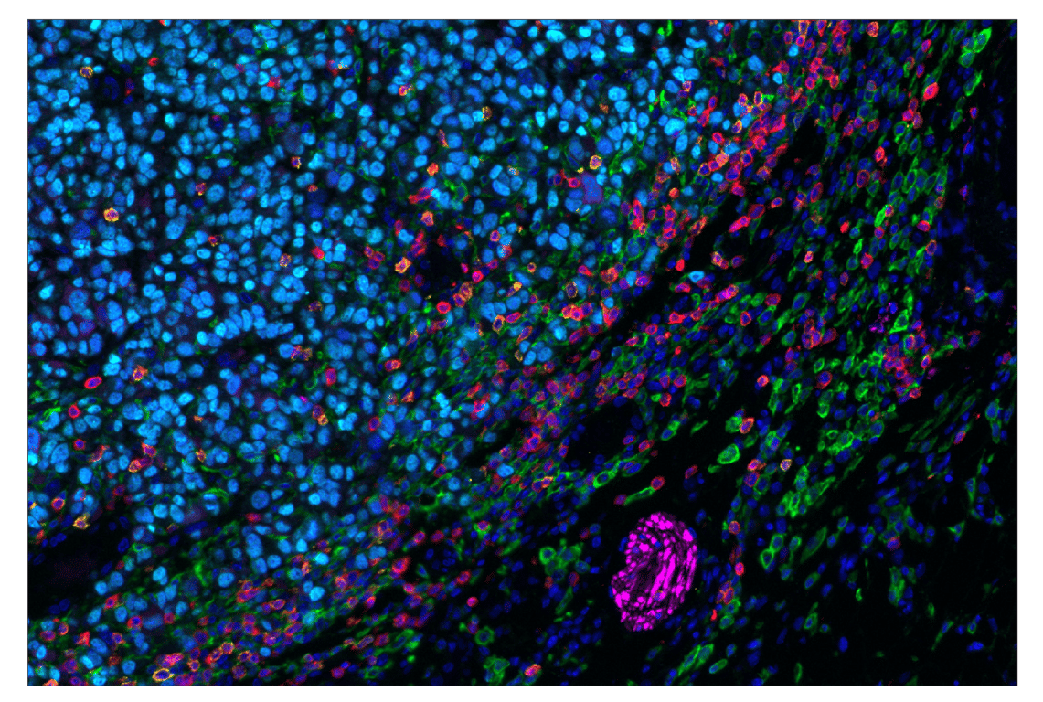 Immunohistochemistry Image 7: Olig2 (E6G6Q) & CO-0124-594 SignalStar<sup>™</sup> Oligo-Antibody Pair