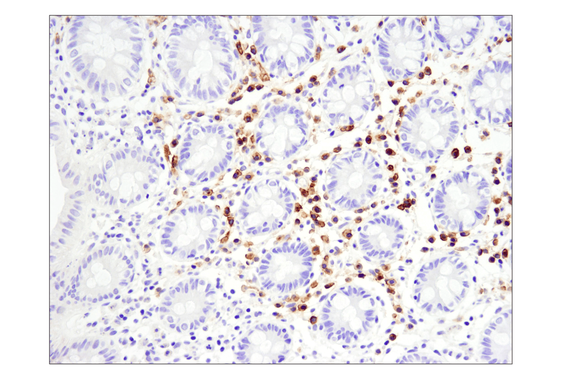 Immunohistochemistry Image 12: TNFRSF17/BCMA (E6D7B) Rabbit Monoclonal Antibody