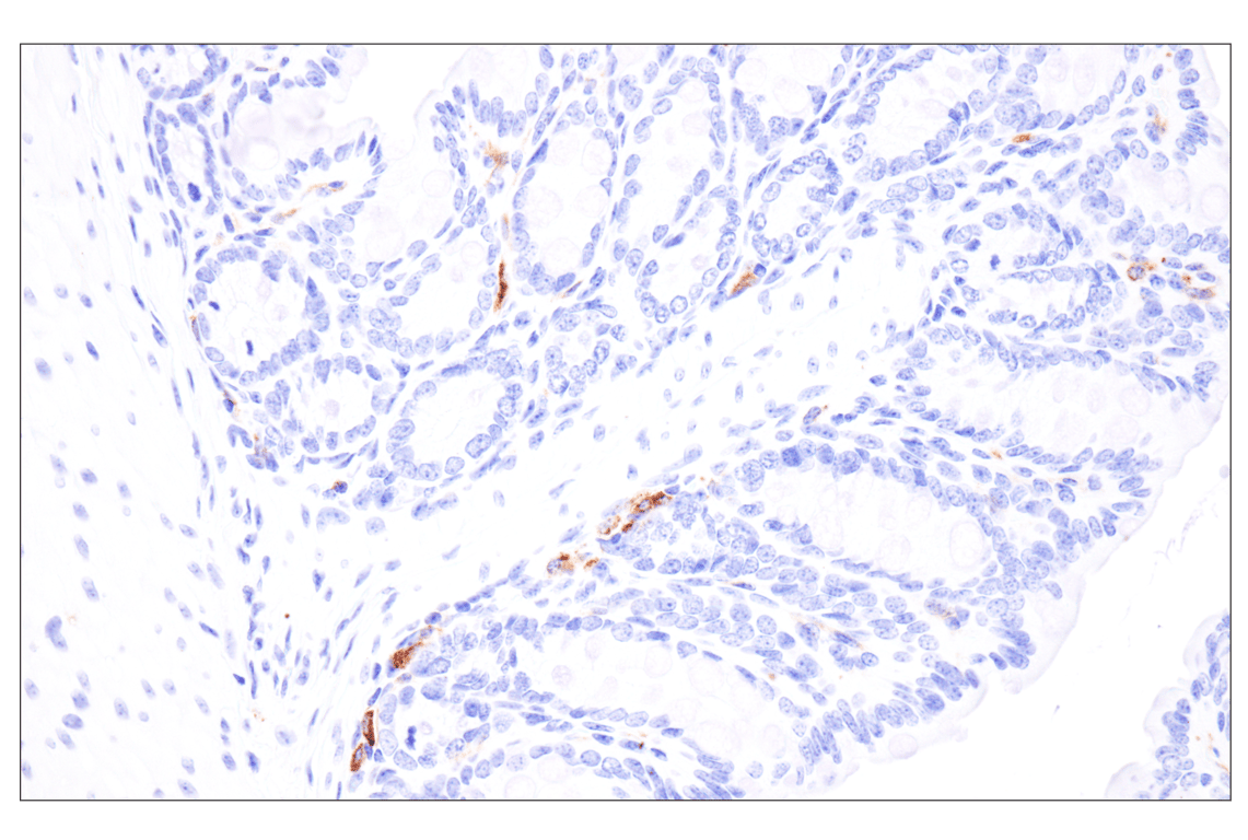 Immunohistochemistry Image 4: MHC Class II (I-E alpha) (F8N7J) Rabbit Monoclonal Antibody