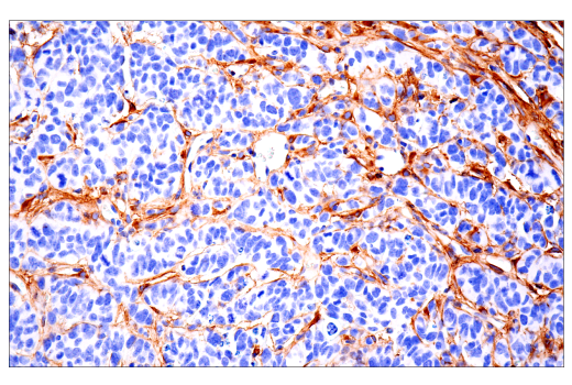 Immunohistochemistry Image 5: COL1A1 (E8F4L) Rabbit Monoclonal Antibody (BSA and Azide Free)