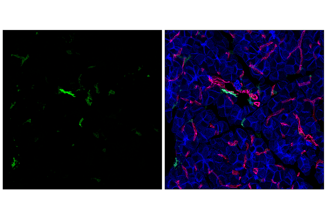 Immunofluorescence Image 3: LYVE-1 (E5P8S) Rabbit Monoclonal Antibody