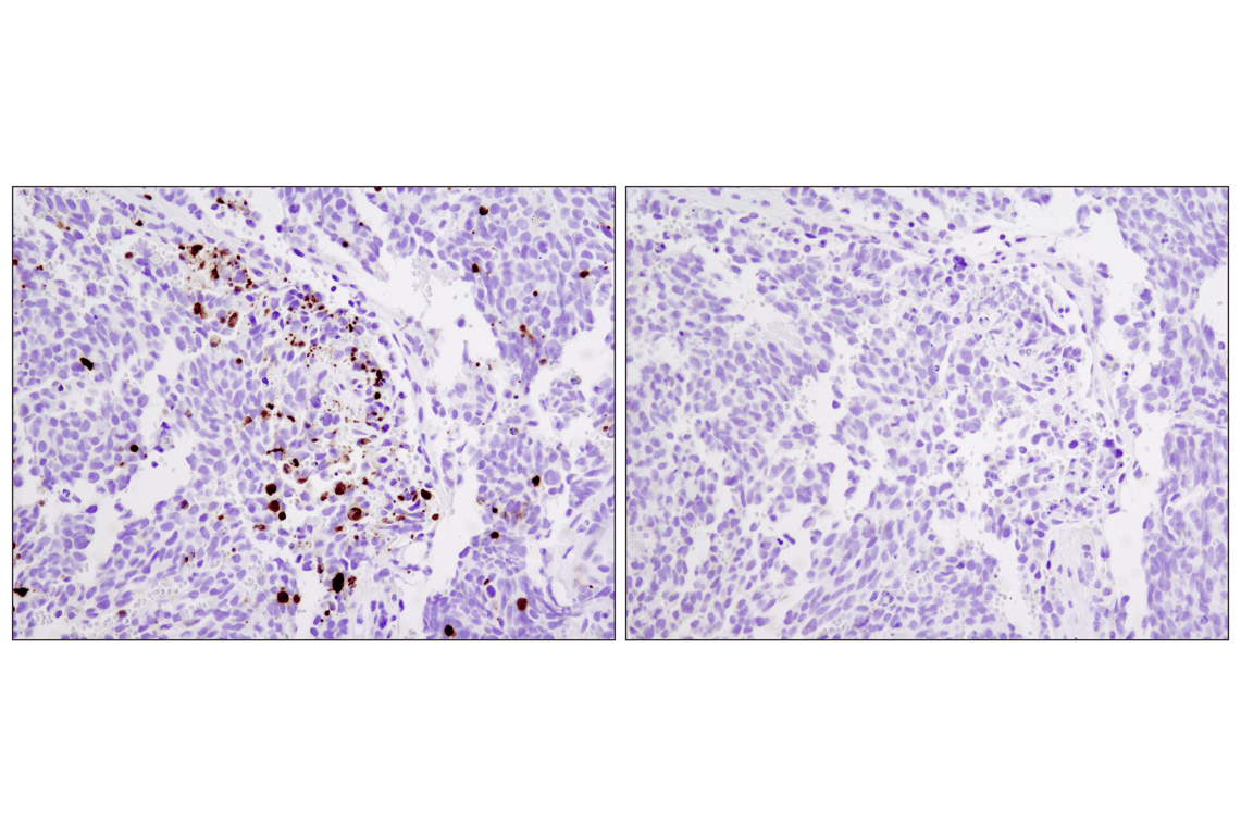 Immunohistochemistry Image 2: SignalStain<sup>®</sup> Apoptosis (Cleaved Caspase-3) IHC Detection Kit