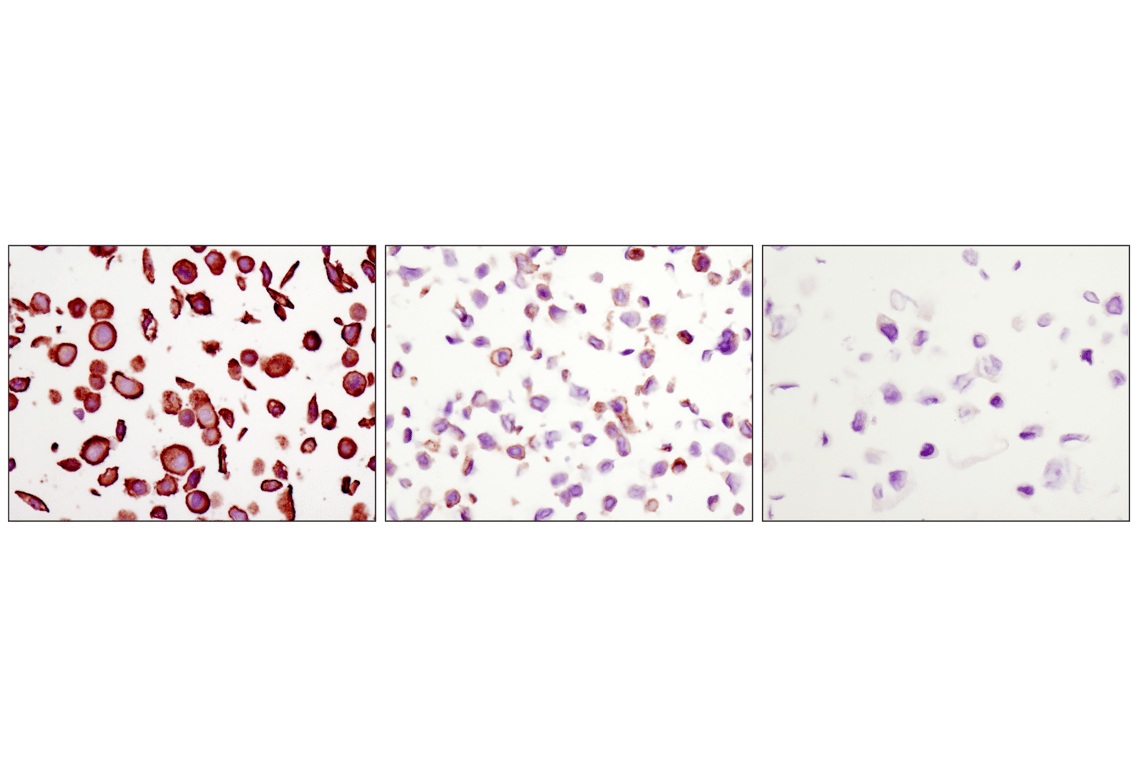 Immunohistochemistry Image 5: EGF Receptor (D38B1) Rabbit Monoclonal Antibody