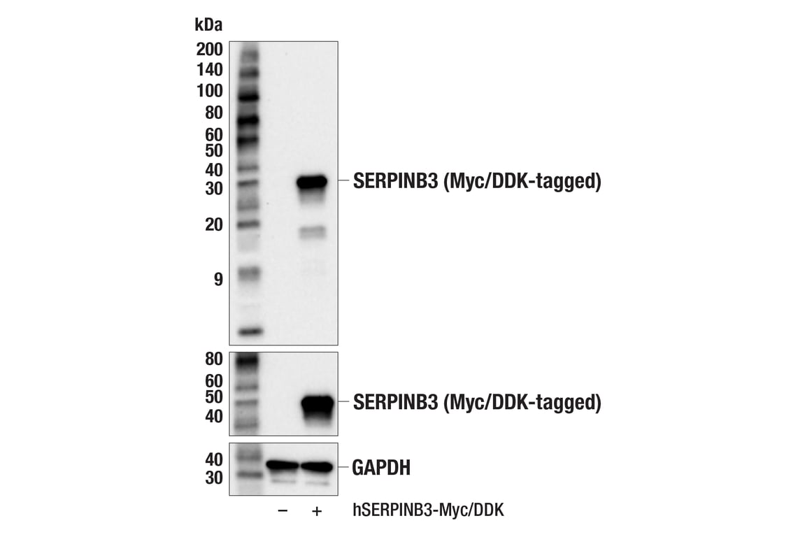 Western Blotting Image 2: SERPINB3 (F2I8O) Rabbit Monoclonal Antibody