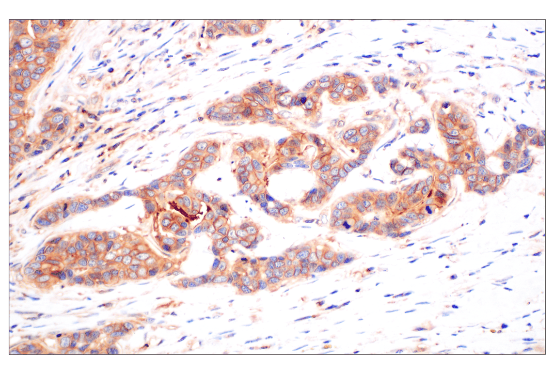 Immunohistochemistry Image 5: CD58 (F1C9B) Rabbit Monoclonal Antibody