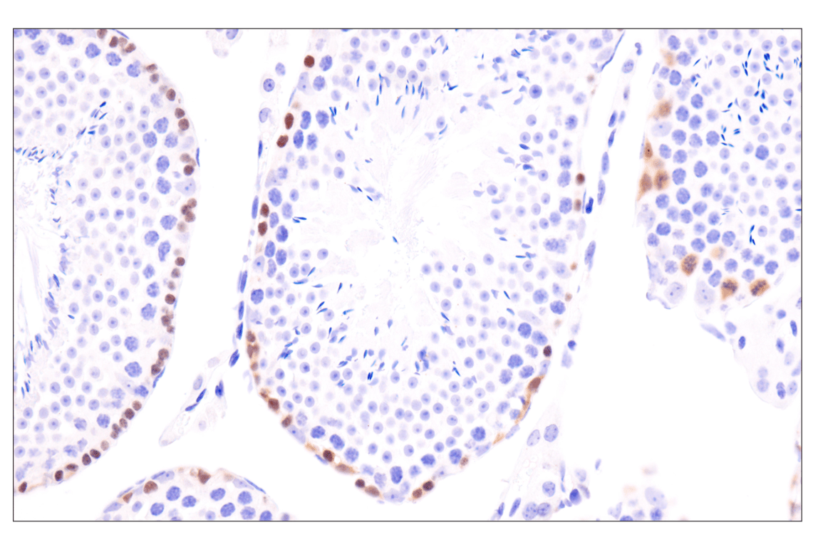 Immunohistochemistry Image 3: p19 ARF (F6F7N) Rabbit Monoclonal Antibody