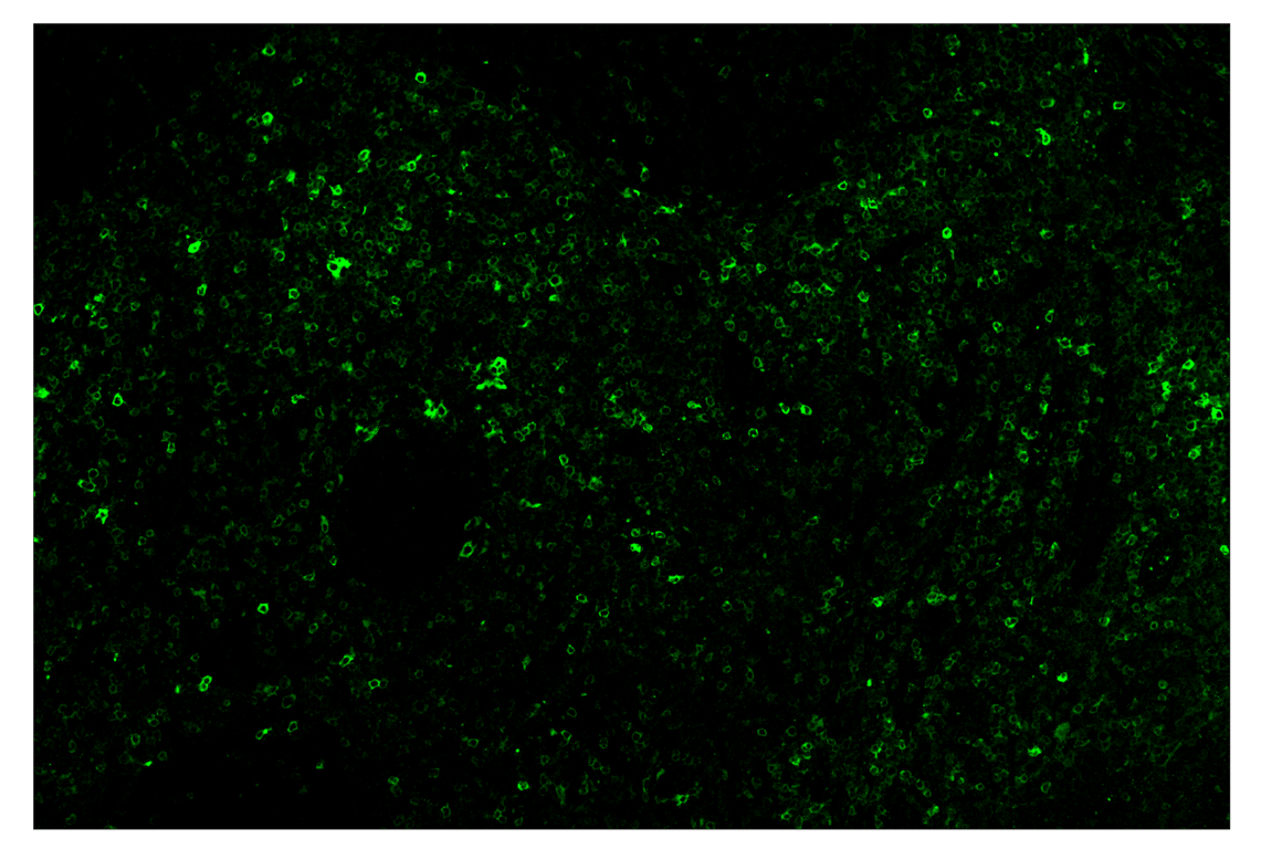 Immunohistochemistry Image 2: Phospho-SLP-76 (Ser376) (E3G9U) & CO-0018-488 SignalStar<sup>™</sup> Oligo-Antibody Pair