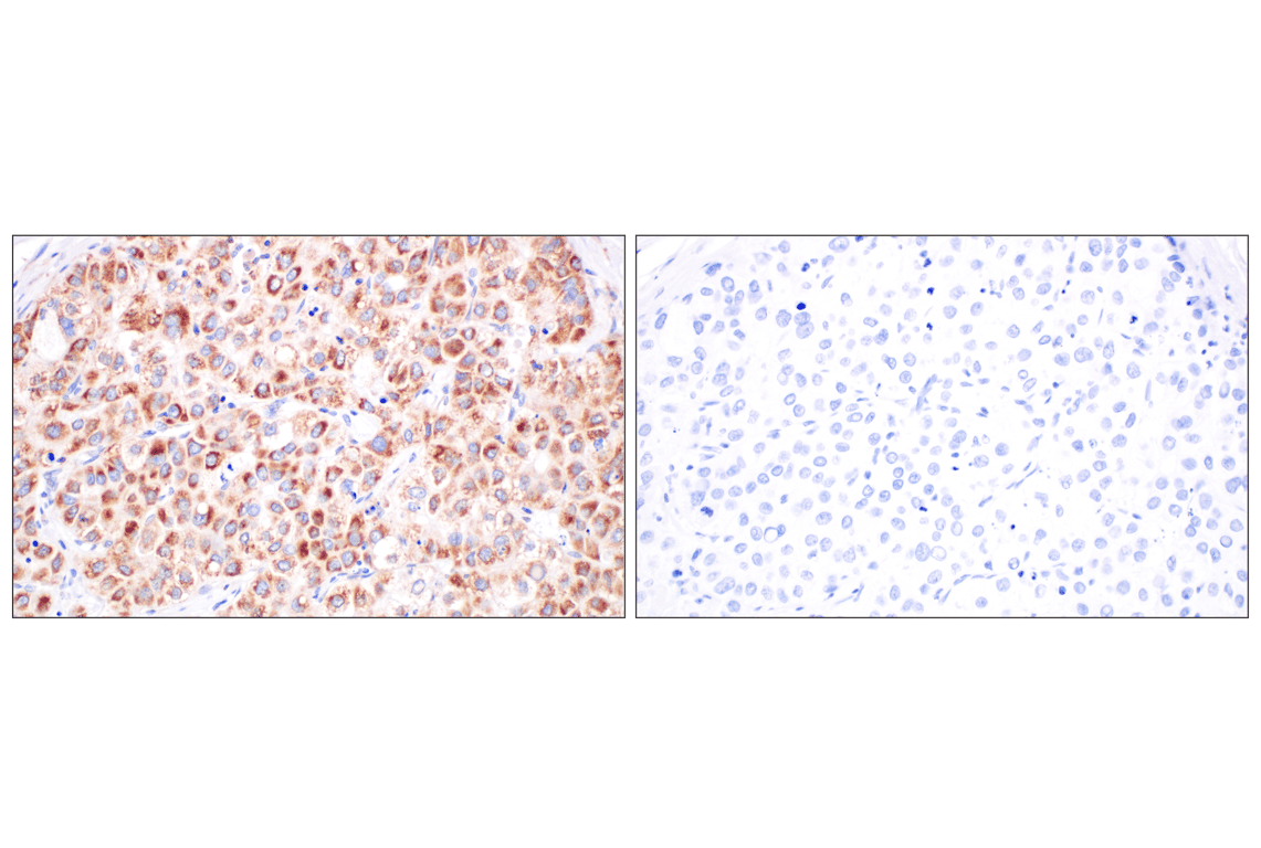 Immunohistochemistry Image 8: CPT1A (E3Y1V) Rabbit Monoclonal Antibody