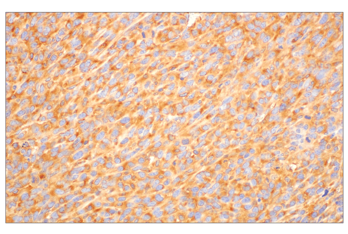 Immunohistochemistry Image 7: RACK1 (D59D5) Rabbit Monoclonal Antibody (BSA and Azide Free)