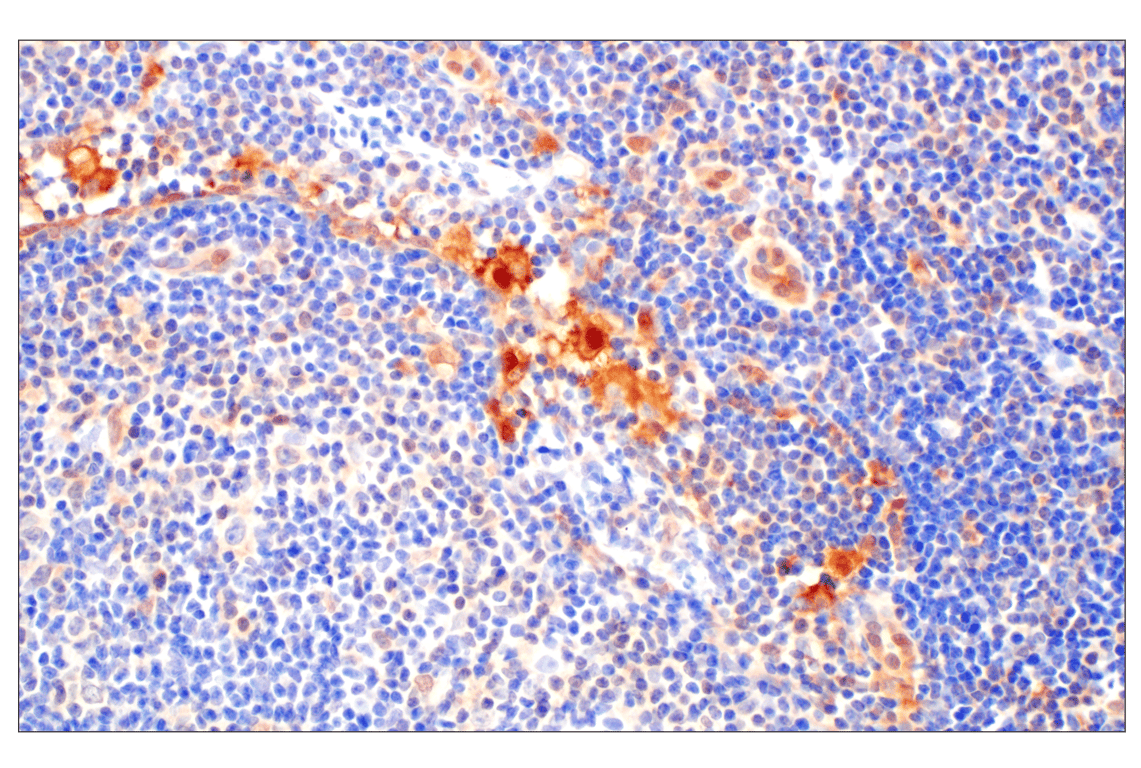 Immunohistochemistry Image 1: Galectin-8/LGALS8 (F9O3T) Rabbit Monoclonal Antibody