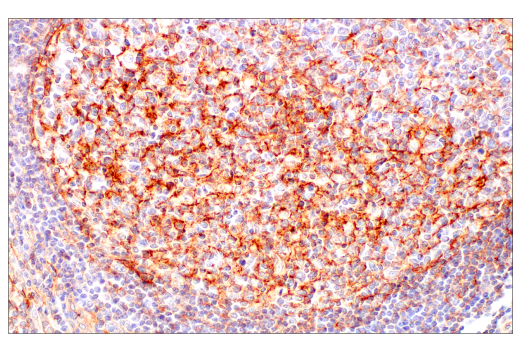 Immunohistochemistry Image 11: JAM-A (E8D2N) Rabbit Monoclonal Antibody