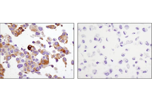 Immunohistochemistry Image 1: PSA/KLK3 (D11E1) Rabbit Monoclonal Antibody