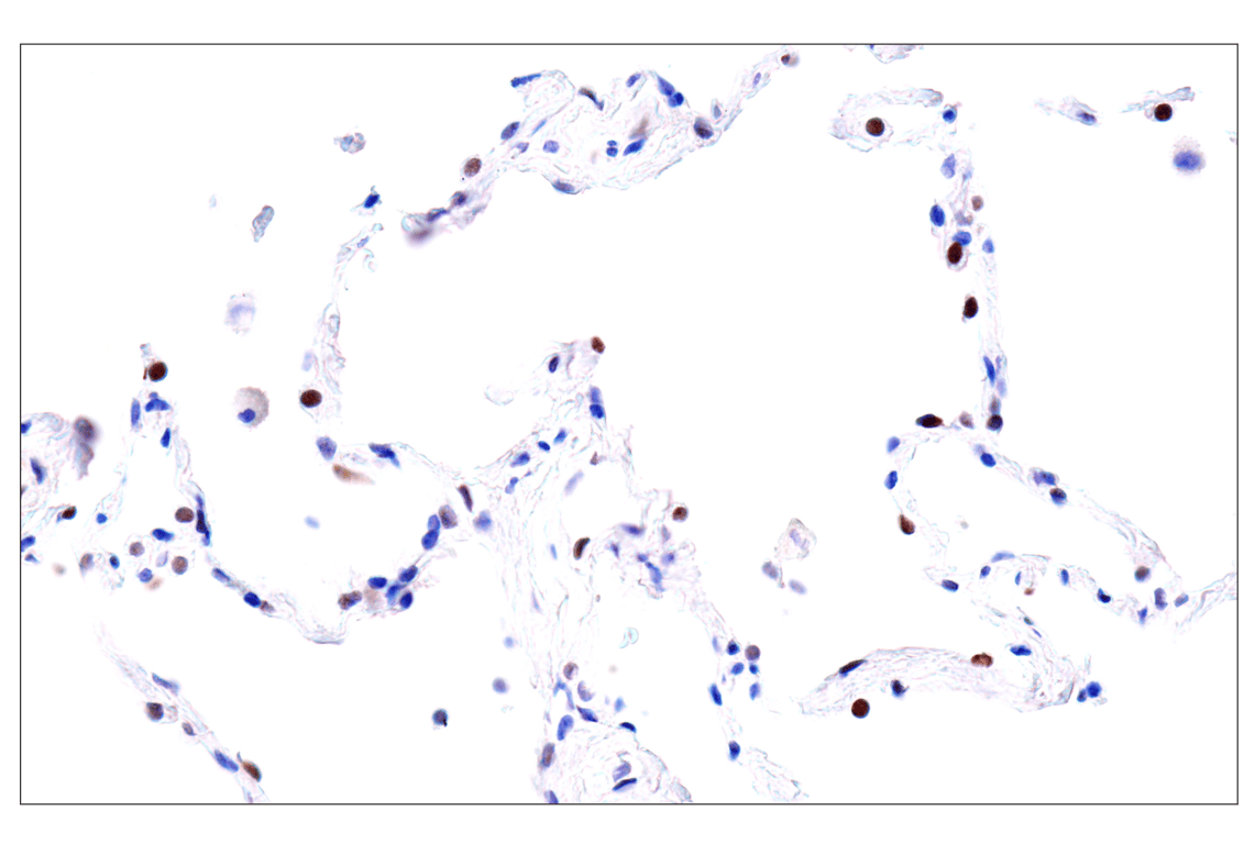 Immunohistochemistry Image 12: GATA-6 (D61E4) XP<sup>®</sup> Rabbit mAb (BSA and Azide Free)