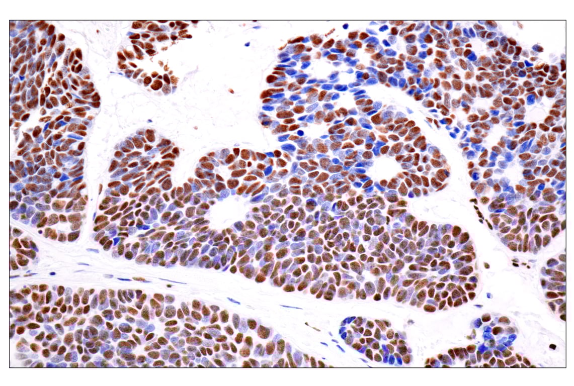 Immunohistochemistry Image 2: ILF3 (E5H6F) Rabbit Monoclonal Antibody
