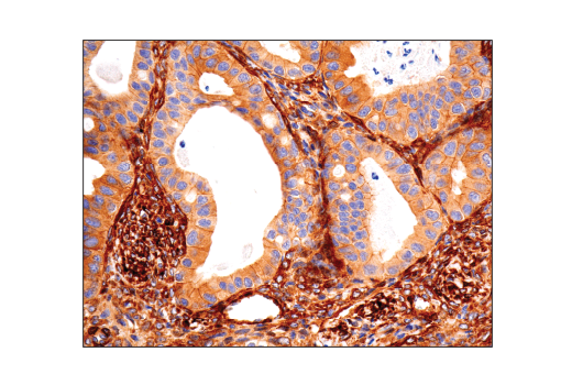 Immunohistochemistry Image 2: Vinculin (E1E9V) Rabbit Monoclonal Antibody