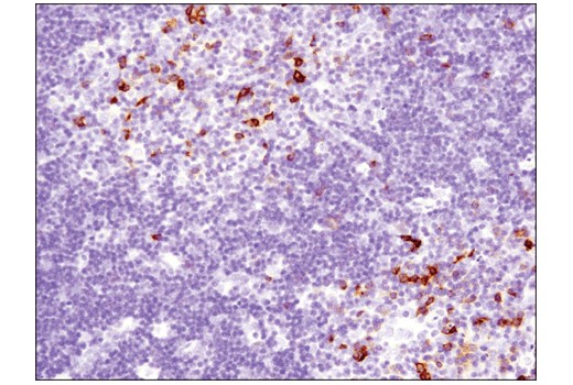 Immunohistochemistry Image 7: OX40 (E9U7O) XP<sup>®</sup> Rabbit mAb