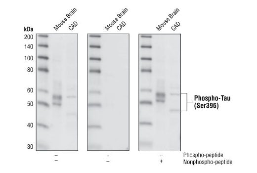 undefined Image 3: PhosphoPlus<sup>®</sup> Tau (Ser396) Antibody Duet