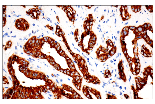 Immunohistochemistry Image 3: Pan-Keratin (5D3/LP34) Mouse Monoclonal Antibody