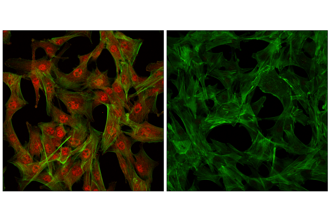 Immunofluorescence Image 1: Akt Antibody