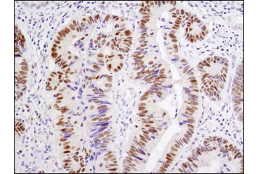 Immunohistochemistry Image 2: Vitamin D3 Receptor (D2K6W) Rabbit Monoclonal Antibody (BSA and Azide Free)