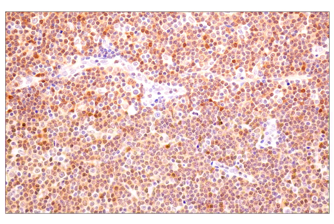 Immunohistochemistry Image 2: ACBP/DBI (E4V8V) Rabbit Monoclonal Antibody