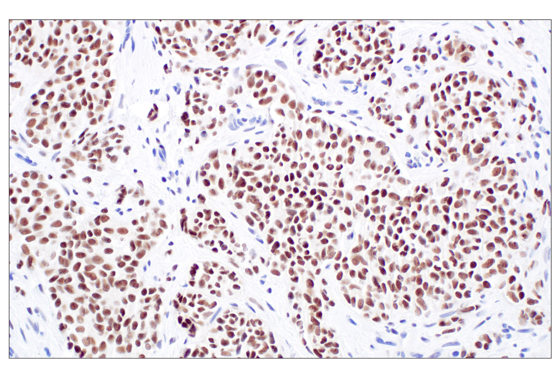 Immunohistochemistry Image 1: WT1 (F3T7B) Rabbit Monoclonal Antibody (Carboxy-terminal Antigen)