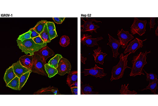Immunofluorescence Image 1: NaPi2b/SLC34A2 (D6W2G) Rabbit Monoclonal Antibody