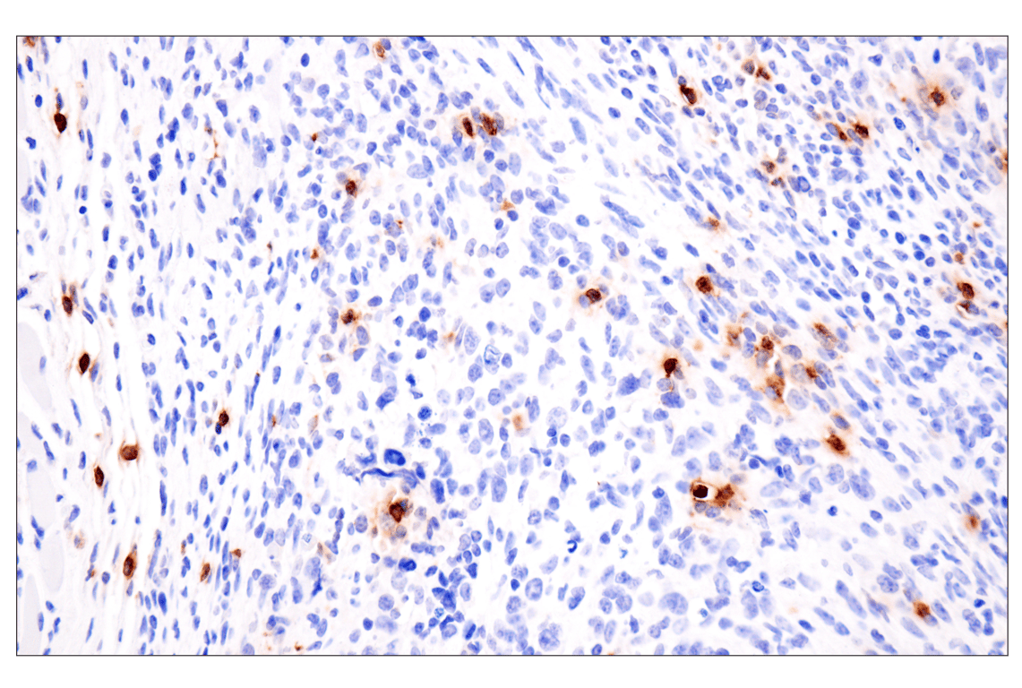 Immunohistochemistry Image 2: Eosinophil cationic protein (F3G7N) Rabbit Monoclonal Antibody