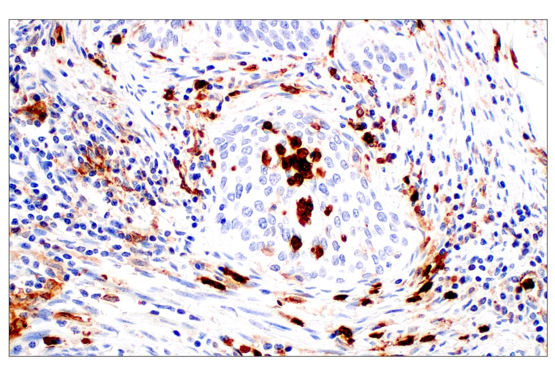 Immunohistochemistry Image 9: CD11b/ITGAM (E3J2F) Rabbit Monoclonal Antibody